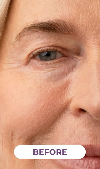 Patricia, 63 — 1