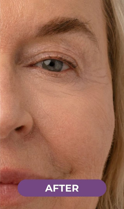 Patricia, 63 — 2